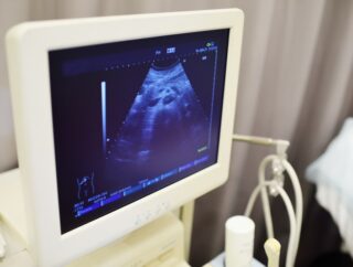Przebieg i wyniki badania ultrasonograficznego – szczegółowy opis